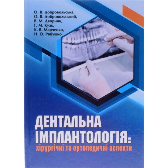 Дентальна імплантологія: хірургічні та ортопедичні аспекти Добровольська О.В. - №1