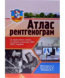 Атлас рентгенограм Шевченко А.І.