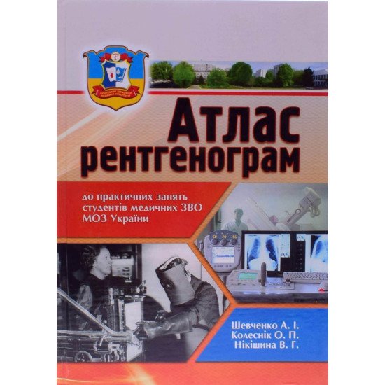 Атлас рентгенограм Шевченко А.І. - №1