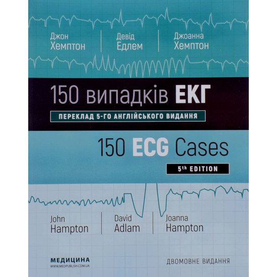 160 випадків ЕКГ Хемптон Д.Р. - №1