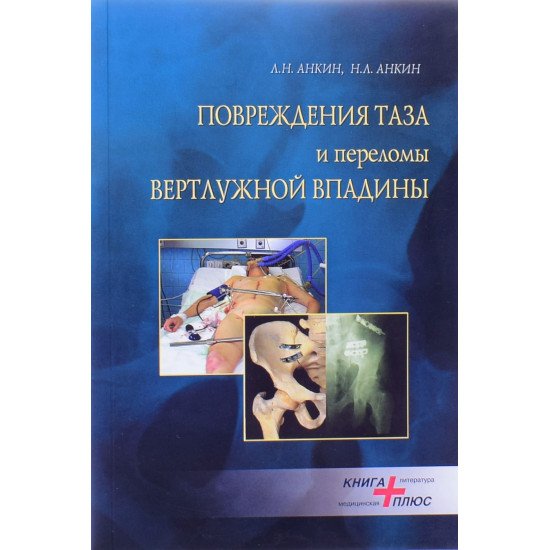 Ушкодження тазу та переломи вертлужної западини Анкін Л.М. (Російською) - №1