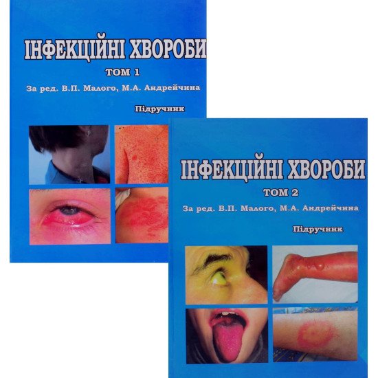 Комплект з 2-х книг Інфекційні хвороби - №1