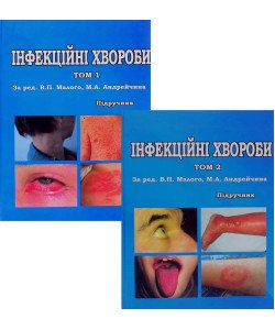 Комплект з 2-х книг Інфекційні хвороби