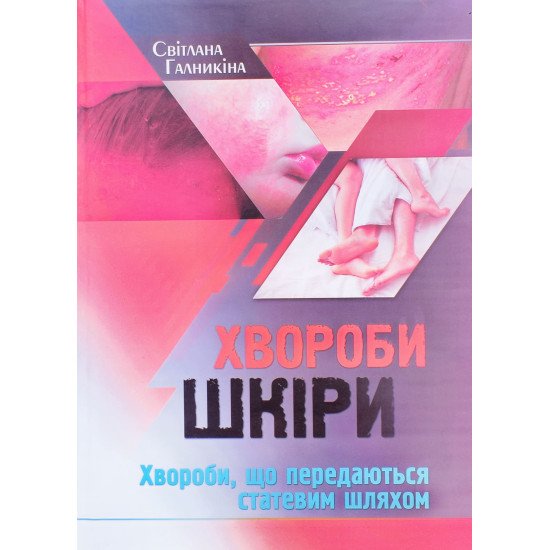 Хвороби шкіри. Хвороби, що передаються статевим шляхом Світлана Галникіна - №1