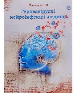 Герпесвірусні нейроінфекції людини