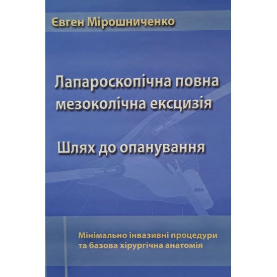 Лапароскопічна повна мезоколічна ексцизія. Мінімально інвазивні процедури та базова хірургічна анатомія - №1