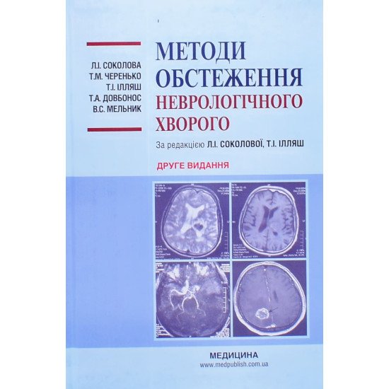Методи обстеження неврологічного хворого  - №1