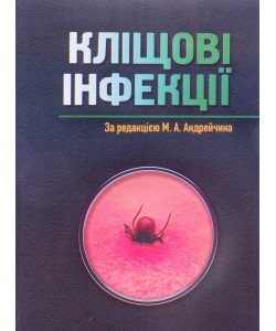 Кліщові інфекції 