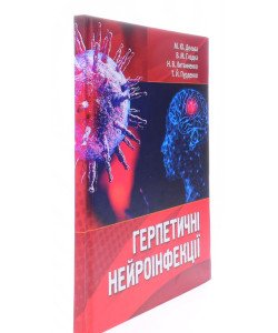 Герпетичні нейроінфекції