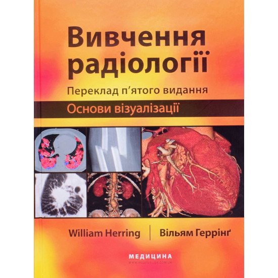 Вивчення радіології: основи візуалізації - №1