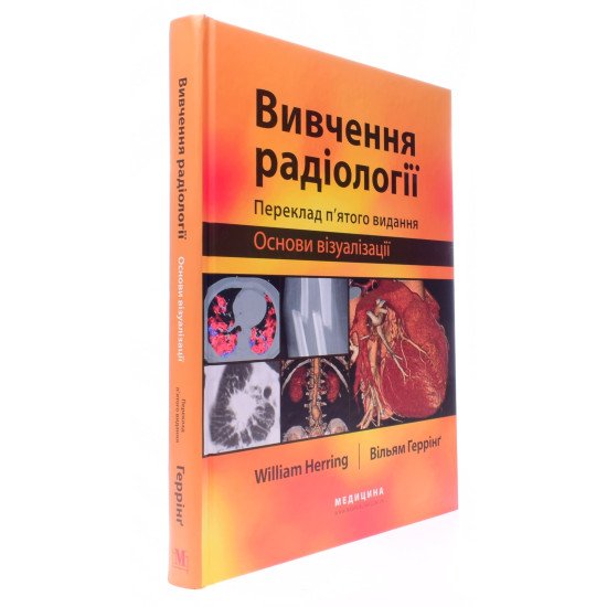 Вивчення радіології: основи візуалізації - №2