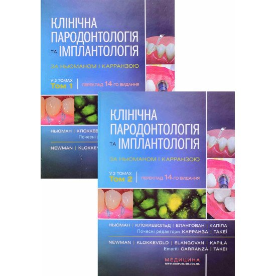 Комплект клінічна пародонтологія та імплантологія за Ньюманом і Карранзою  - №1