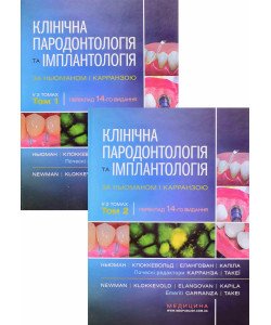 Комплект клінічна пародонтологія та імплантологія за Ньюманом і Карранзою 