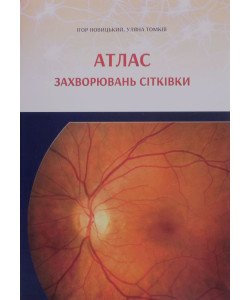 Атлас захворювань сітківки