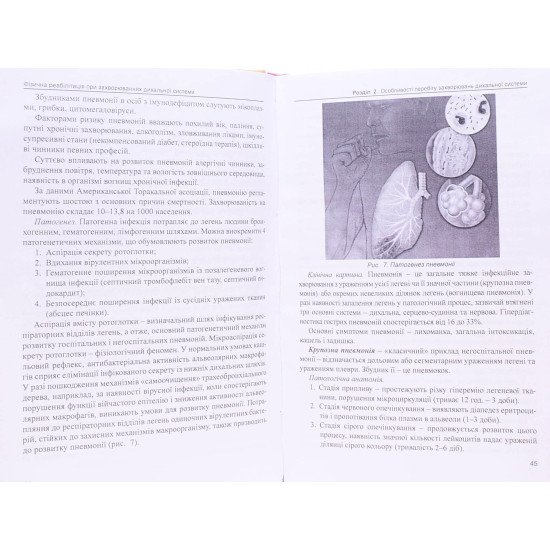 Фізична реабілітація при захворюваннях дихальної системи - №4