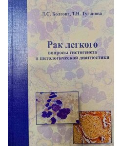 Рак легень: питання гістогенезу та цитологічної діагностики (Російською)
